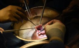 Are pig heart transplants a reality? Successful surgery shows it’s possible